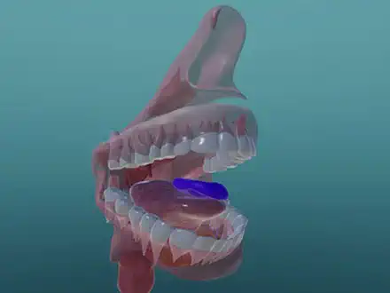 Where Does Food Go?